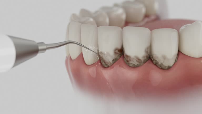 Reliable Dental Implants contractor in Beecher, IL by Smile Center Dentistry